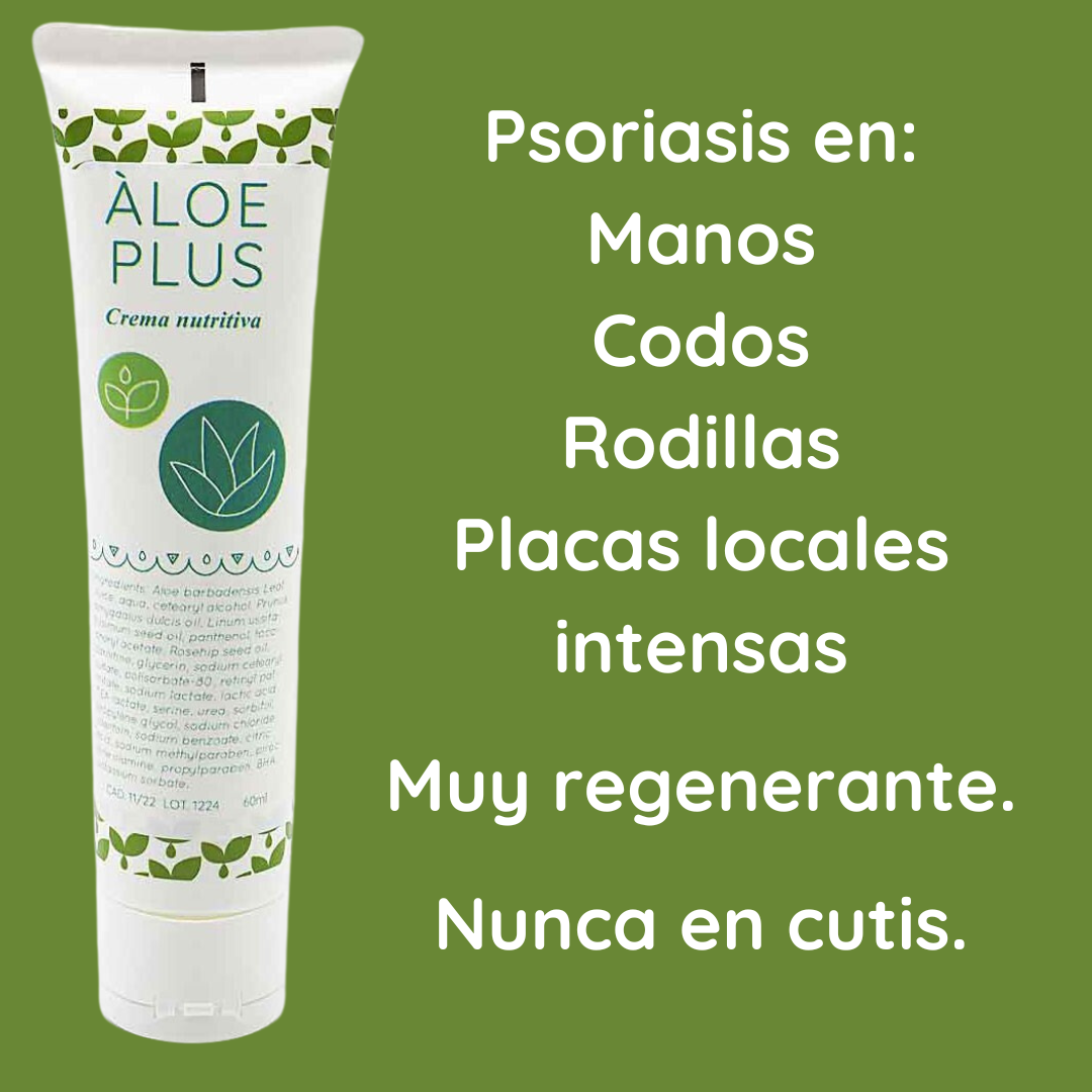 Crema nutritiva áloe plus 1842 para psoriasis en manos, codos, rodillas, placas locales e intensas.